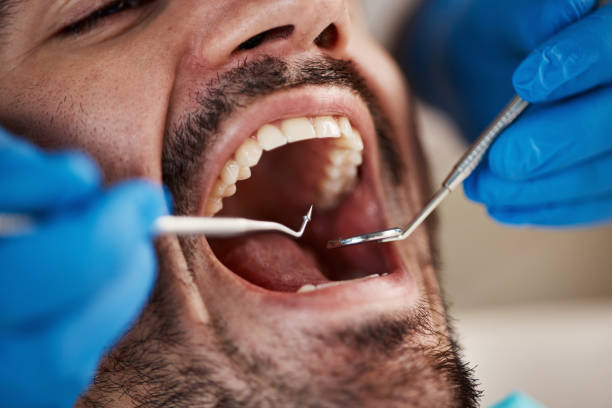 Best Cosmetic Emergency Dentistry in Terrace Park, OH
